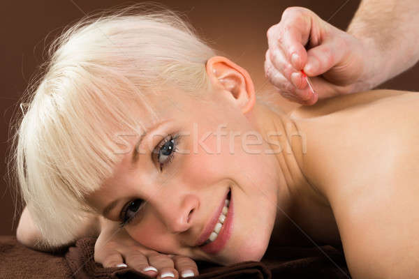 Fiatal nő akupunktúra kezelés közelkép szépségszalon férfi Stock fotó © AndreyPopov