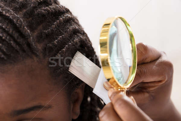 皮膚科醫生 看 頭髮 放大鏡 女子 商業照片 © AndreyPopov