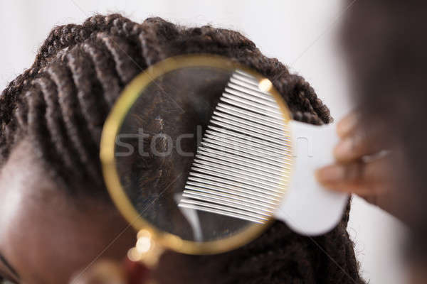 Dermatolog uita păr lupa femeie Imagine de stoc © AndreyPopov