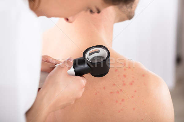 Dermatolog pacient femeie medic medical Imagine de stoc © AndreyPopov