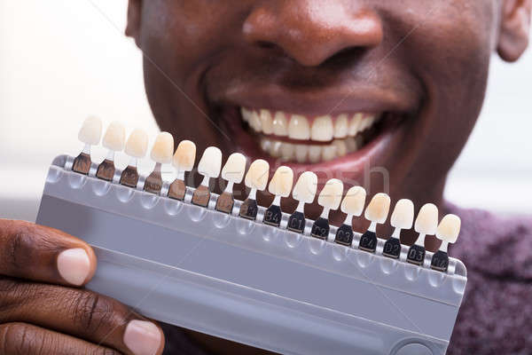 Férfi összeillő fogak közelkép mosolyog implantátum Stock fotó © AndreyPopov