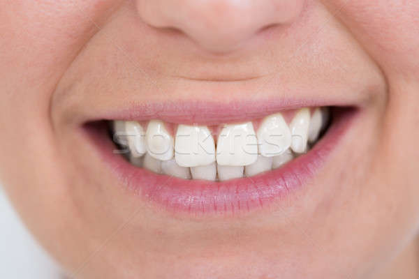 Kadın gülen sağlıklı beyaz diş mutlu Stok fotoğraf © AndreyPopov