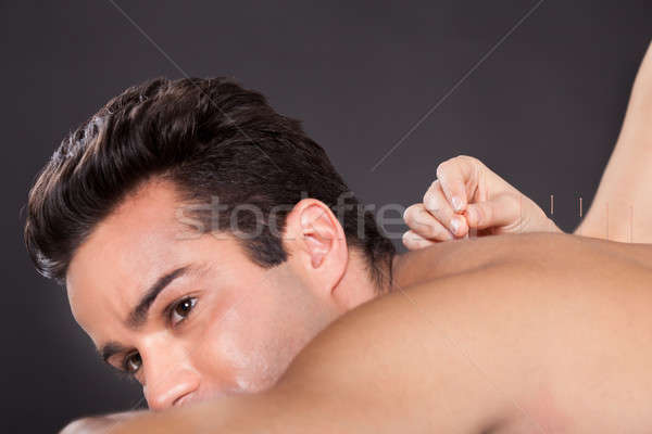 Foto stock: Hombre · acupuntura · tratamiento · primer · plano · joven · spa