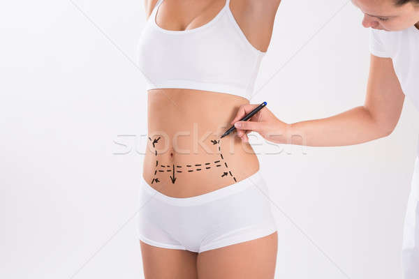 Stockfoto: Chirurg · vrouw · liposuctie · chirurgie · afbeelding · witte