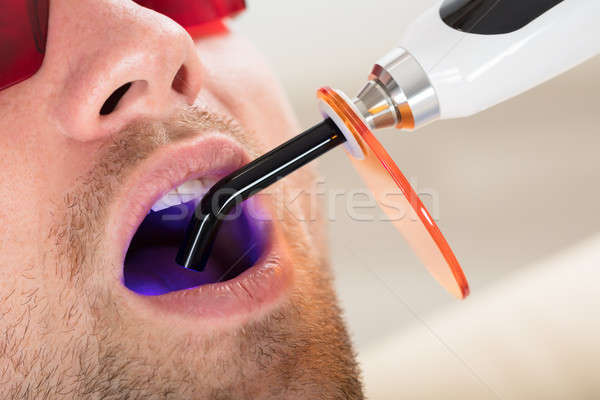 Lit Dental Curing UV Light In Man's Mouth Stock photo © AndreyPopov