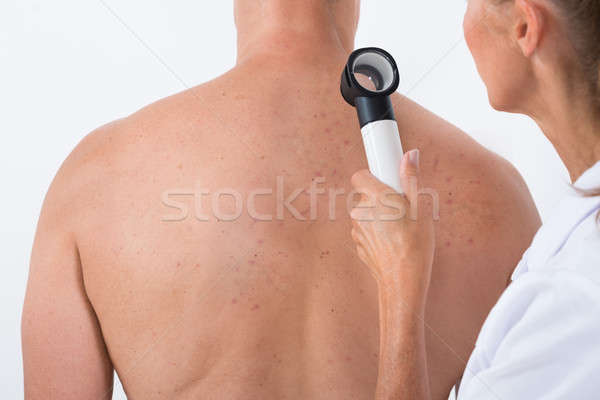 Arts onderzoeken acne huid Maakt een reservekopie vrouwelijke Stockfoto © AndreyPopov