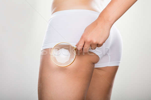 Mujer celulitis nalga lupa mano cuerpo Foto stock © AndreyPopov