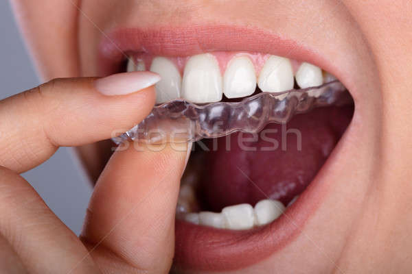 Vrouw transparant tanden hand medische Stockfoto © AndreyPopov