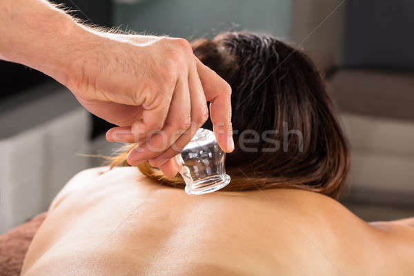 Therapist Placing Cups On Woman's Back Stock photo © AndreyPopov