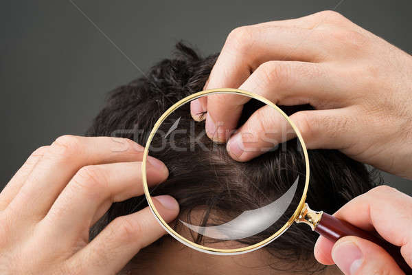 Dermatologo capelli primo piano lente di ingrandimento mano medico Foto d'archivio © AndreyPopov