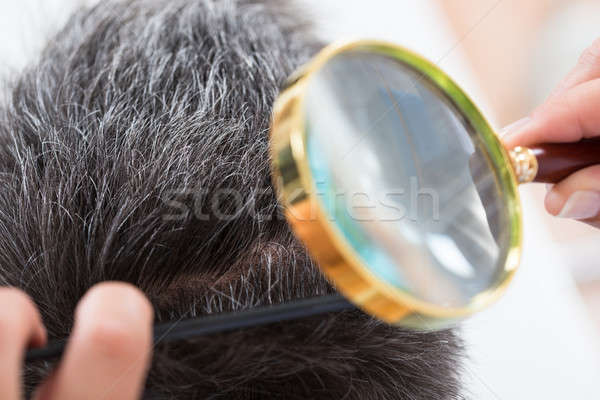 Dermatolog păr lupa femeie piele Imagine de stoc © AndreyPopov