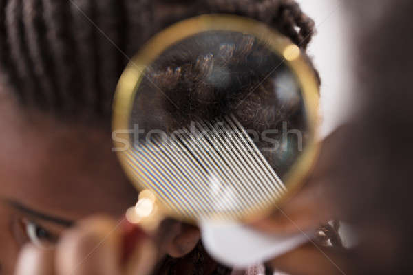 Bőrgyógyász néz haj közelkép nagyító nő Stock fotó © AndreyPopov