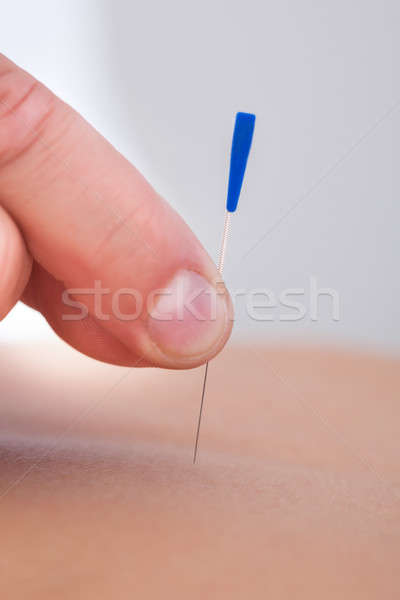 Akupunktur tedavi spa makro detay Stok fotoğraf © AndreyPopov