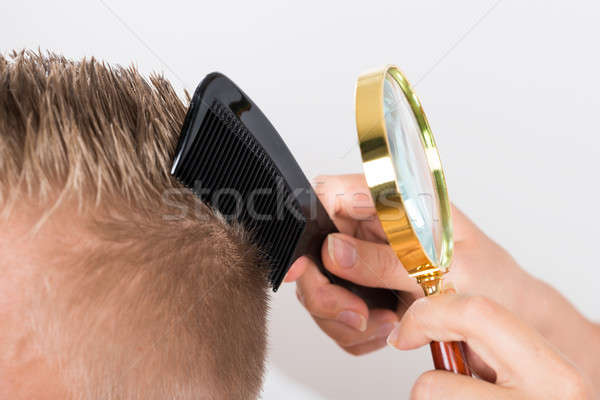 Doctor Looking At Patient's Hair Through Magnifying Glass Stock photo © AndreyPopov