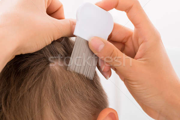 Doctor Doing Treatment On Boy's Hair Stock photo © AndreyPopov