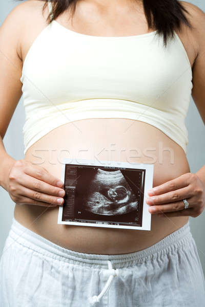 Femme enceinte coup ultrasons scanner enfant à naître [[stock_photo]] © aremafoto