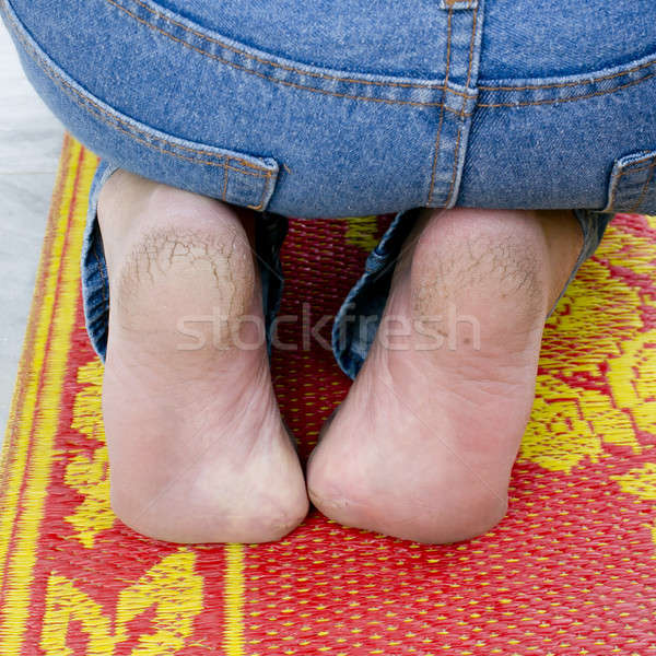 Agrietado talones mujer cuerpo fondo Foto stock © art9858