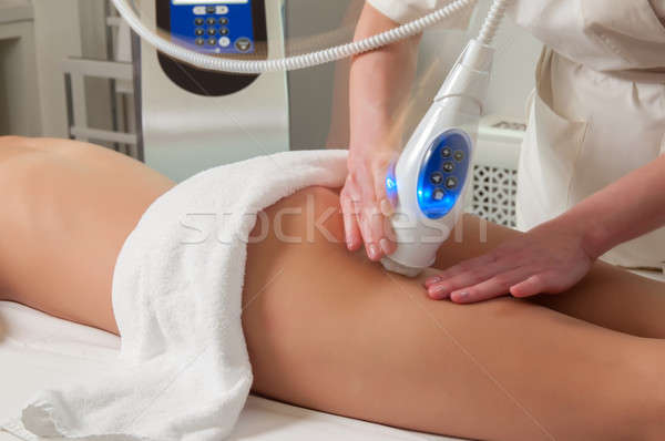 Cellulitis behandeling procedure vrouwen zitvlak vrouw Stockfoto © artfotoss