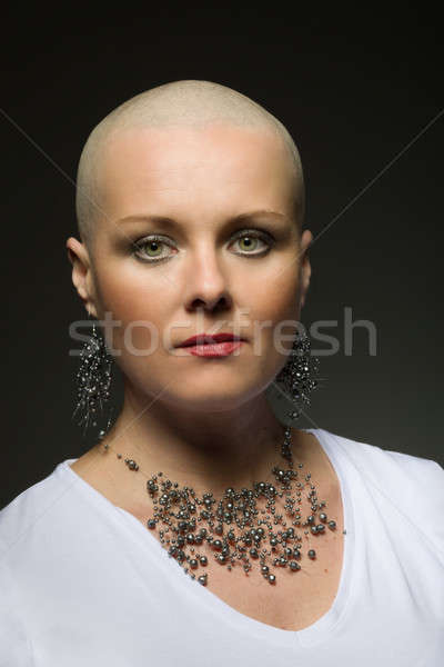 Alopecia Brecon dancer 25 tackles hair loss head on  BBC News