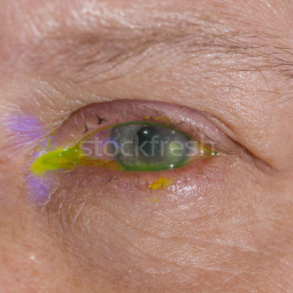 Auge Prüfung medizinischen Gesundheit Hintergrund Stock foto © arztsamui