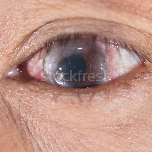 Examen de la vue post oeil médicaux [[stock_photo]] © arztsamui