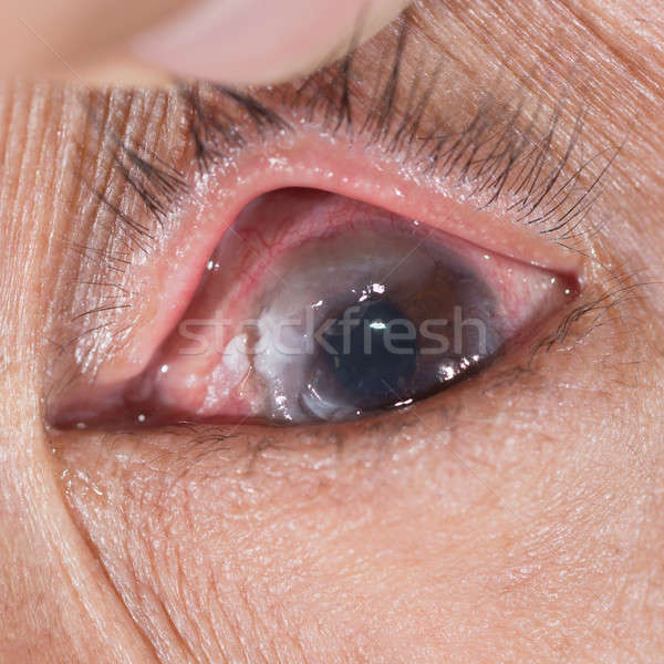 Szemvizsgálat közelkép posta szem vizsgálat orvosi Stock fotó © arztsamui
