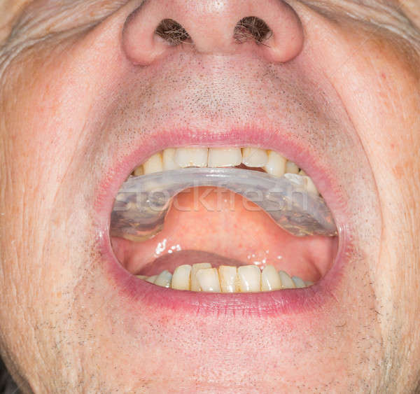 Close up of teeth guard in senior mouth Stock photo © backyardproductions