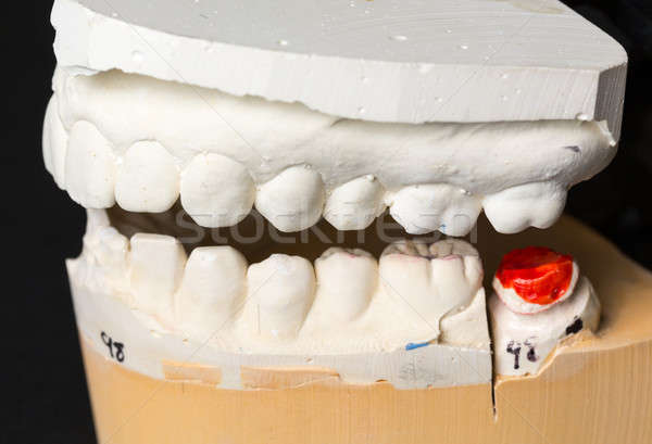 Pleśń zęby pleśń gipsu uśmiech medycznych Zdjęcia stock © backyardproductions
