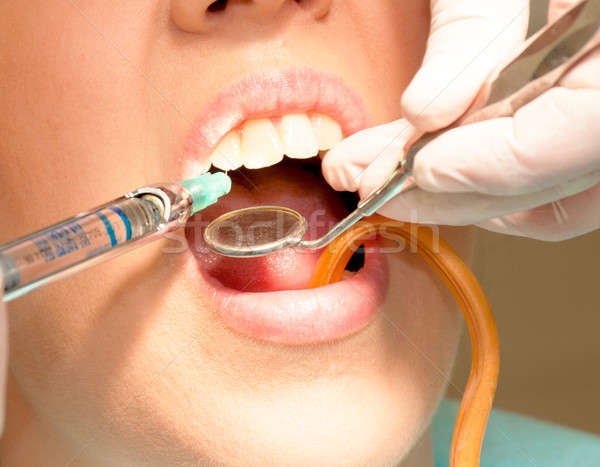 麻醉 牙醫 病人 健康 醫藥 科學 商業照片 © badmanproduction