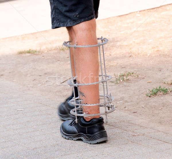 Fractura en la pierna metal bares salud hospital anillo Foto stock © badmanproduction