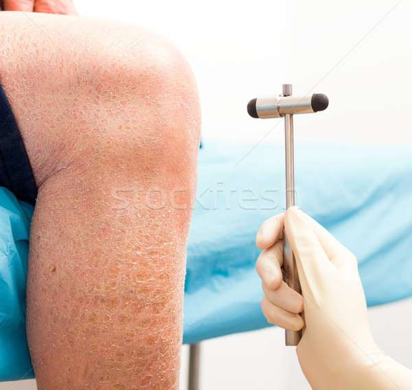 Badanie lekarza starszych kolano odruch Zdjęcia stock © barabasa