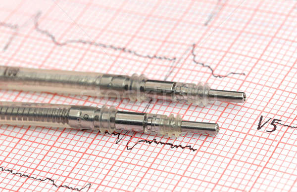 Pacemaker leads on electrocardiograph Stock photo © bdspn