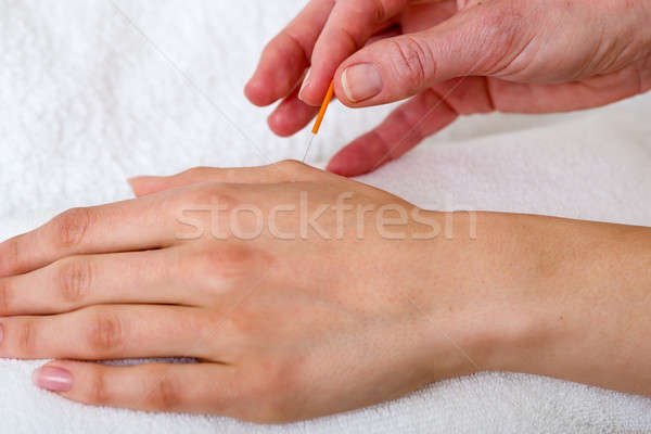Csontkovács jelentkezik akupunktúra tűk közelkép fehér Stock fotó © belahoche