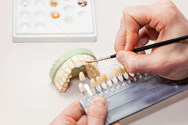 Dentales problemas blanco mesa trabajo Foto stock © belahoche