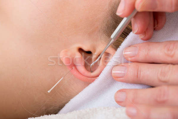 [[stock_photo]]: Femme · acupuncture · chiropraticien · oreille · mains