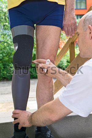 Physiotherapist adjusting prosthetic leg Stock photo © belahoche
