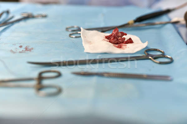 Sangeros tabel mic chirurgical camera de operare Imagine de stoc © bezikus