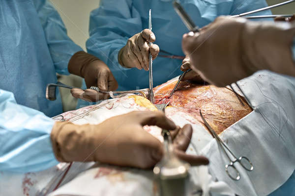 Abdominal operatie proces grup chirurgii Imagine de stoc © bezikus