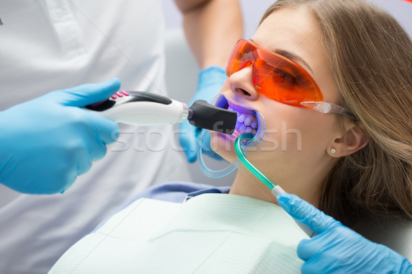 歯 充填 紫外線 ランプ 少女 患者 ストックフォト © bezikus