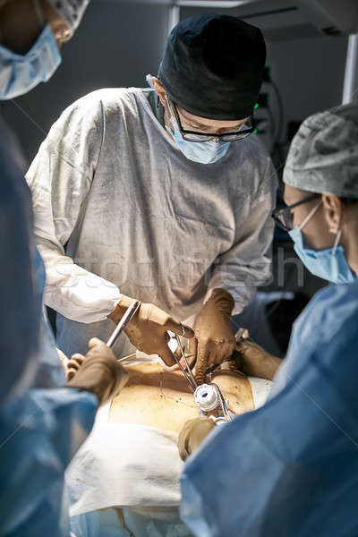Abdominale opération chirurgie salle d'opération équipe médecins Photo stock © bezikus