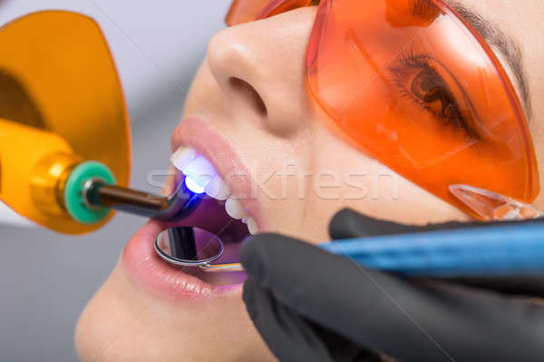 Macro photo of dental treatment Stock photo © bezikus