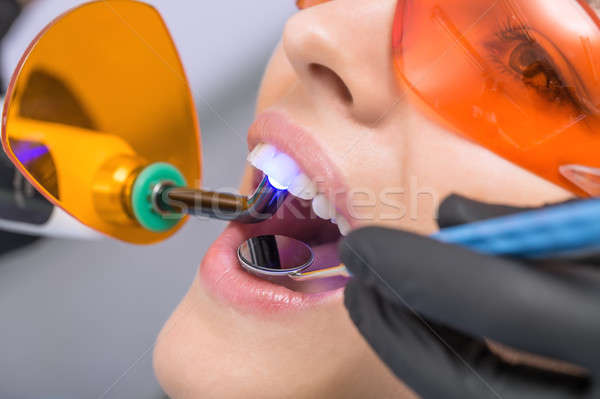 Makró fotó fogászati kezelés csinos lány Stock fotó © bezikus