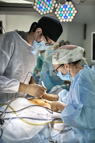 手術 過程 助理 外科 胃 醫生 商業照片 © bezikus