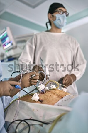 Operatie procede chirurgen camera binnenkant abdominaal Stockfoto © bezikus
