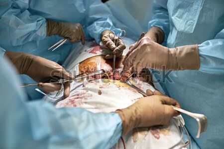 Laparoscopy operation process Stock photo © bezikus