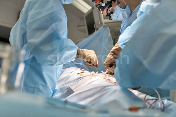 Karın operasyon süreç doktorlar dışarı Stok fotoğraf © bezikus