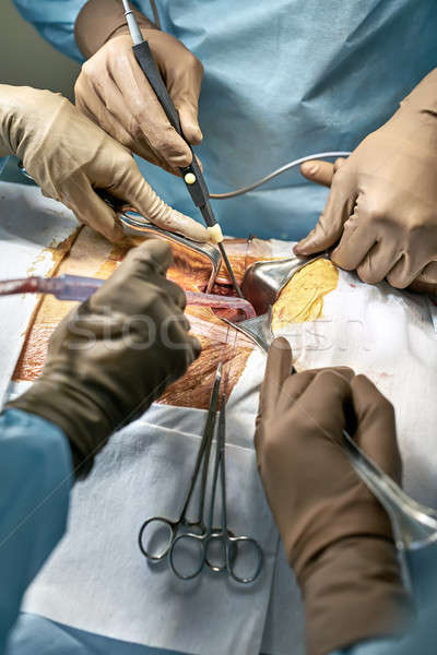 Abdominal operatie proces medic cu laser scalpel Imagine de stoc © bezikus