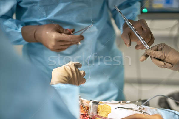 Abdominális operáció folyamat asszisztens sebész tart Stock fotó © bezikus