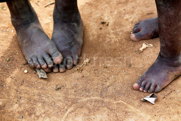 Pé africano crianças crianças mundo África Foto stock © boggy