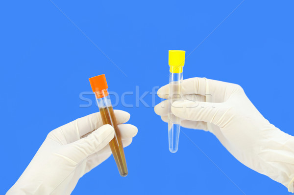 Clean and dirty water samples in hands Stock photo © brozova